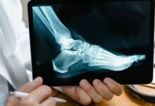 mobile call source analysis